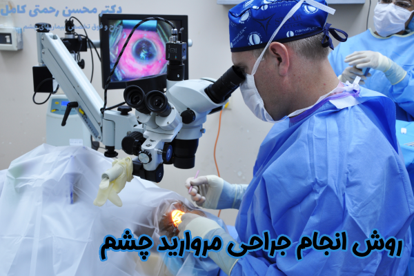 روش انجام جراحی مروارید چشم