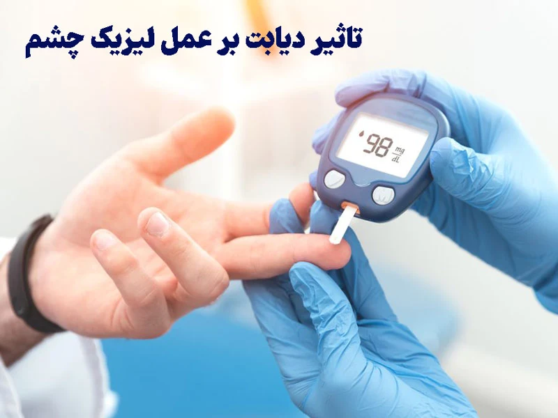 عوارض لیزیک در بیماران دیابتی