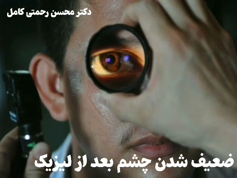 آیا چشم ها بعد از لیزیک ضعیف می شوند؟