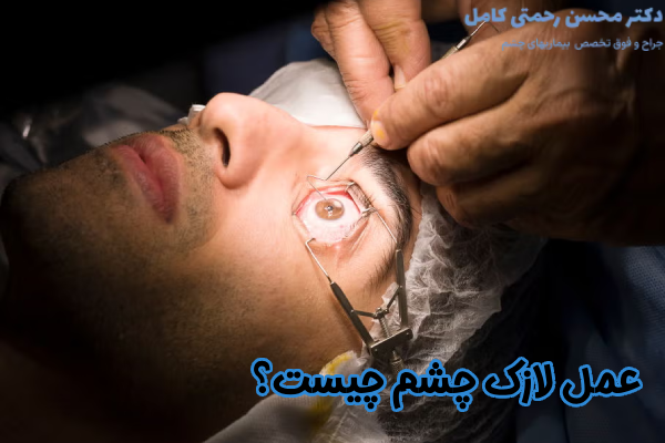 لازک چشم چیست