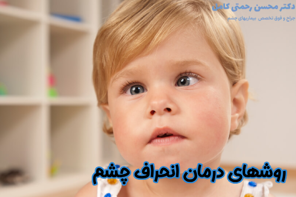 روشهای درمان انحراف چشم