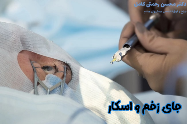 جای زخم و اسکار