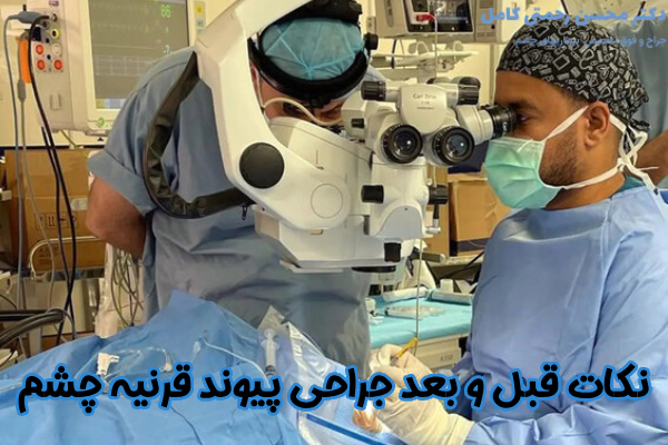 نکات قبل و بعد پیوند قرنیه چشم