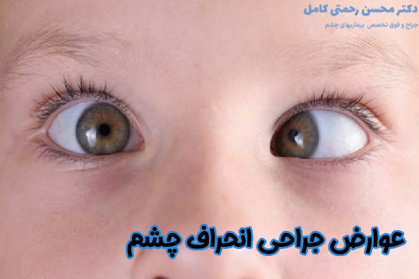 عوارض جراحی انحراف چشم چیست